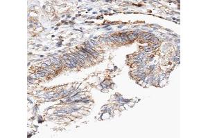 ABIN6266837 at 1/100 staining human lung tissue sections by IHC-P.