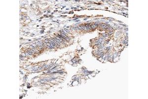 ABIN6266837 at 1/100 staining human lung tissue sections by IHC-P. (Claudin 7 anticorps  (C-Term))