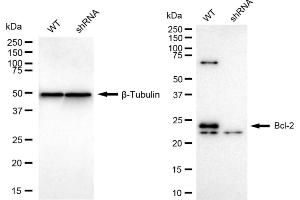 Western blotting analysis using Bcl-2 antibody (ABIN7797719). (Recombinant Bcl-2 anticorps)