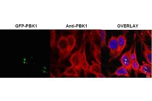 Image no. 1 for anti-Ribosomal L1 Domain Containing 1 (RSL1D1) (Internal Region) antibody (ABIN401398) (RSL1D1 anticorps  (Internal Region))