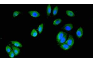 Immunofluorescence staining of A549 cells with ABIN7150721 at 1:200, counter-stained with DAPI. (MAP2K6 anticorps  (AA 1-334))
