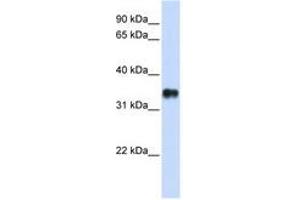 Image no. 1 for anti-Potassium Channel Tetramerisation Domain Containing 7 (KCTD7) (N-Term) antibody (ABIN6740422) (KCTD7 anticorps  (N-Term))