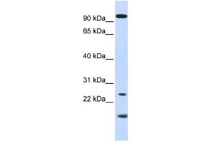 GUCA1A antibody used at 1 ug/ml to detect target protein. (GCAP1 anticorps)