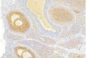 ABIN6259721 and ABIN6269341 at 1/100 staining Rat ovary tissue by IHC-P. (Acetyl-CoA Carboxylase alpha anticorps  (N-Term))