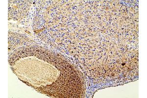 ABIN6267452 at 1/100 staining rat ovarian tissue sections by IHC-P.