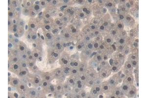 Detection of IL17RD in Rat Liver Tissue using Polyclonal Antibody to Interleukin 17 Receptor D (IL17RD) (IL17RD anticorps  (AA 356-605))