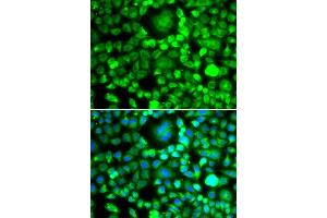 Immunofluorescence analysis of MCF-7 cells using BLID antibody. (BLID anticorps  (AA 1-108))