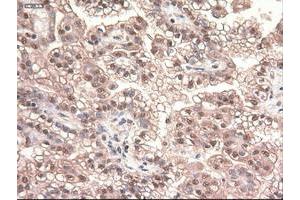 Image no. 14 for anti-Myc Proto-Oncogene protein (MYC) antibody (ABIN1497012) (c-MYC anticorps)
