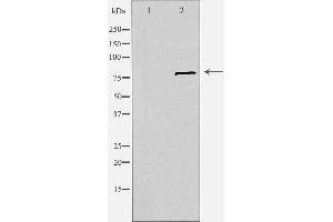 Western blot analysis of extracts from Jurkat cells, using SLC6A15 antibody. (SLC6A15 anticorps  (N-Term))