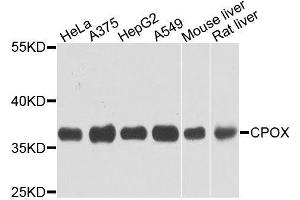 Western blot analysis of extracts of various cell lines, using CPOX antibody. (CPOX anticorps  (AA 111-454))