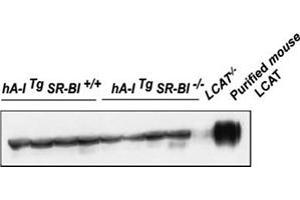Western blot analysis of plasma LCAT protein mass using Lcat polyclonal antibody .