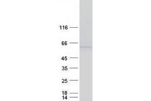 Validation with Western Blot