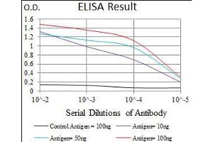 Black line: Control Antigen (100 ng), Purple line: Antigen(10 ng), Blue line: Antigen (50 ng), Red line: Antigen (100 ng), (PCNA anticorps  (AA 53-196))