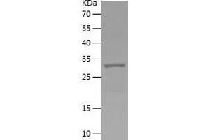 Western Blotting (WB) image for Complement Component 5a (C5a) (AA 1-77) protein (His-IF2DI Tag) (ABIN7122470)