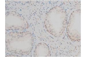 ABIN6267395 at 1/200 staining Human prostate tissue sections by IHC-P. (GATA1 anticorps  (pSer142))
