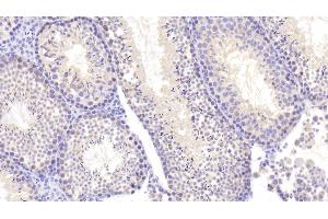 Detection of NEIL3 in Mouse Testis Tissue using Polyclonal Antibody to Nei Endonuclease VIII Like Protein 3 (NEIL3)