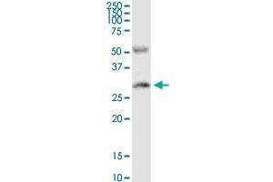 PPP2R3B MaxPab rabbit polyclonal antibody. (PPP2R3B anticorps  (AA 1-225))