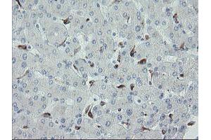 Image no. 1 for anti-Myosin Light Chain 7, Regulatory (MYL7) antibody (ABIN1499491)
