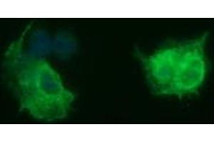 Image no. 2 for anti-Tubulin, beta 2B (TUBB2B) antibody (ABIN1501575) (TUBB2B anticorps)
