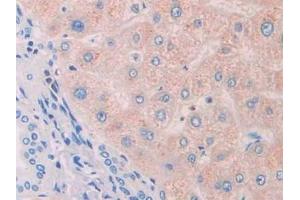 Detection of PROS in Human Liver Tissue using Polyclonal Antibody to Protein S (PROS) (PROS1 anticorps  (AA 481-667))