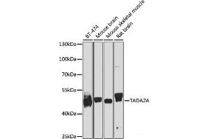 Western blot analysis of extracts of various cell lines using TADA2A Polyclonal Antibody at dilution of 1:1000. (TADA2L anticorps)