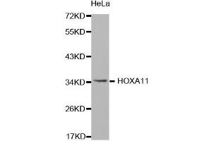 Western Blotting (WB) image for anti-Homeobox A11 (HOXA11) antibody (ABIN1873073) (Homeobox A11 anticorps)
