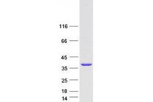 Validation with Western Blot