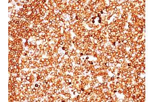 Formalin-fixed, paraffin-embedded human Tonsil stained with CD79a Mouse Monoclonal Antibody (JCB117 + HM47/A9).