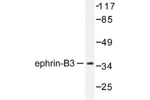 Image no. 1 for anti-Ephrin B3 (EFNB3) antibody (ABIN265403) (Ephrin B3 anticorps)