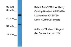 WB Suggested Anti-CERKL  Antibody Titration: 0. (CERKL anticorps  (N-Term))