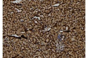 anti-Tumor Protein, Translationally-Controlled 1 Pseudogene (FKSG2) antibody