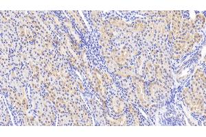 Detection of Slit2 in Human Kidney Tissue using Polyclonal Antibody to Slit Homolog 2 (Slit2)