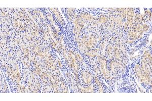 Detection of Slit2 in Human Kidney Tissue using Polyclonal Antibody to Slit Homolog 2 (Slit2) (SLIT2 anticorps  (AA 664-777))