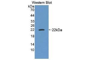 Western blot analysis of the recombinant protein. (MEF2A anticorps  (AA 1-162))