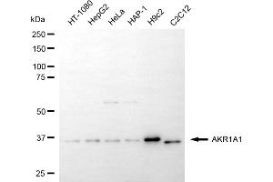 Western blotting analysis using AKR1A1 antibody (ABIN7797568).