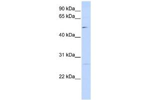 PPM1M antibody used at 1 ug/ml to detect target protein. (PPM1M anticorps)