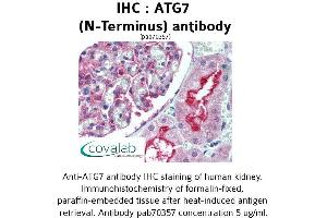 Image no. 1 for anti-ATG7 Autophagy Related 7 (ATG7) (N-Term) antibody (ABIN1732022) (ATG7 anticorps  (N-Term))