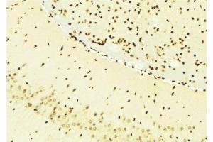 ABIN6276295 at 1/100 staining Mouse brain tissue by IHC-P. (BMI1 anticorps  (Internal Region))
