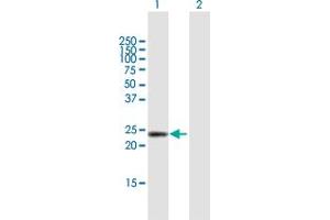 Western Blot analysis of DMRTB1 expression in transfected 293T cell line by DMRTB1 MaxPab polyclonal antibody. (DMRTB1 anticorps  (AA 1-189))