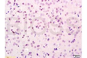 Formalin-fixed and paraffin embedded rat brain tissue labeled with Anti-SMURF2 Polyclonal Antibody, Unconjugated (ABIN753178) at 1:200 followed by conjugation to the secondary antibody, (SP-0023), and DAB staining