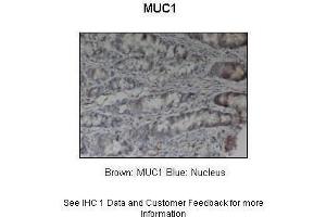 Sample Type :  Pig stomach  Primary Antibody Dilution :  1:200  Secondary Antibody :  Anti-rabbit-HRP  Secondary Antibody Dilution :  1:1000  Color/Signal Descriptions :  Brown: MUC1 Blue: Nucleus  Gene Name :  MUC1  Submitted by :  Dr. (MUC1 anticorps  (Middle Region))