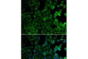 Immunofluorescence analysis of HeLa cells using MSR1 Polyclonal Antibody (Macrophage Scavenger Receptor 1 anticorps)