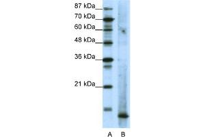 WB Suggested Anti-MDS1 Antibody Titration:  1.