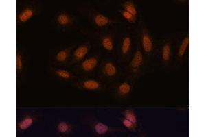 Immunofluorescence analysis of U-2 OS cells using SNIP1 Polyclonal Antibody at dilution of 1:100.