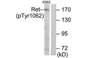 Western blot analysis of extracts from K562 cells, using Ret (Phospho-Tyr1062) Antibody. (Ret Proto-Oncogene anticorps  (pTyr1062))