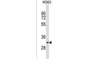 SYCE1L Antibody (C-term) (ABIN1536838 and ABIN2838126) western blot analysis in K562 cell line lysates (35 μg/lane).