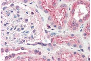Human Kidney (formalin-fixed, paraffin-embedded) stained with OGG1 antibody ABIN337126 at 2. (OGG1 anticorps  (AA 282-297))