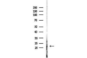 anti-Rhox Homeobox Family, Member 1 (RHOXF1) (Internal Region) antibody