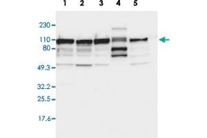 Western blot analysis of Lane 1: RT-4, Lane 2: U-251 MG, Lane 3: A-431, Lane 4: Liver, Lane 5: Tonsil with CTAGE5 polyclonal antibody . (MIA2 anticorps  (AA 392-507))