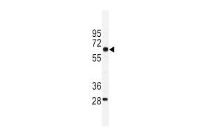 Western blot analysis of PKM1 antibody (C-term ) (ABIN391688 and ABIN2841593) in mouse testis tissue lysates (35 μg/lane). (PKM1 (AA 383-417), (C-Term) anticorps)
